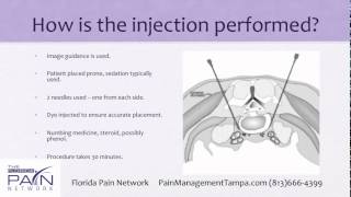 Superior Hypogastric Plexus Block at a Top Tampa Pain Clinic [upl. by Branen433]