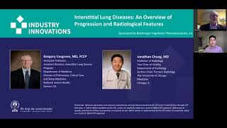 Interstitial Lung Diseases An Overview of Progression and Radiological Features [upl. by Derfnam]