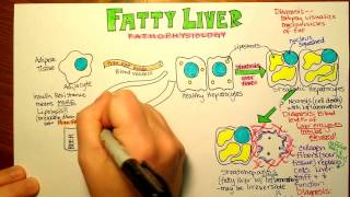 Fatty Liver Pathophysiology [upl. by Mervin]