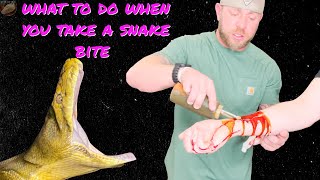 A Reticulated Python Bites You What Do You Do [upl. by Eisiam]