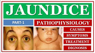 JAUNDICE  PART1  PATHOPHYSIOLOGY  CAUSES  SIGN amp SYMPTOMS  DIAGNOSIS [upl. by Ronica567]