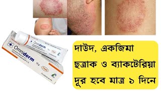 Omniderm Cream এর কাজ কি  দাউদ একজিমা চুলকানি ছত্রাক ও ব্যাকটেরিয়া দূর করার ভালো ক্রিম [upl. by Bannister]