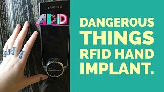 RFID Transponder Chip Implant [upl. by Hpotsirhc905]