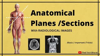 Anatomical Planes Sections and its Importance in Radiology Department [upl. by Aredna]