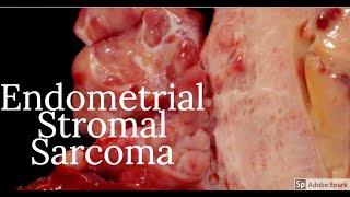 The Staging and Grading of Cancer [upl. by Solon]