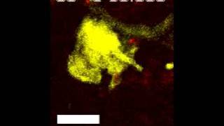 A dermal dendrite cell containing multiple vacuoles capturing an Leishmania parasite [upl. by Delaney494]