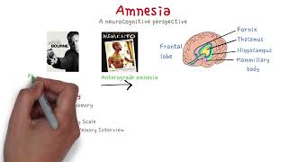 Amnesia  MinsEducation [upl. by Rebeka]