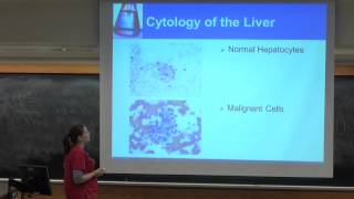 Careers in MCB Cytotechnology Pt 1 [upl. by Ursula79]