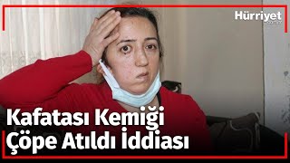 Ameliyat Olan Hemşireden Şok İddia Kafatası Kemiğini Çöpe Attılar [upl. by Dowdell]