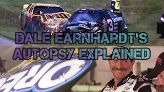 Famous Autopsies Dale Earnhardt [upl. by Loginov]