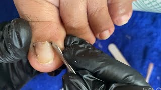 Home Pedicure Vlog💅 by arianjeanjag IngrownDryskin Removal [upl. by Otreblasiul525]