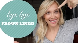 HOW TO GET RID OF FROWN LINES QUICK AND EASY NATURALLY [upl. by Virgin]