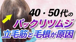 40代・50代の「パックリつむじ」の悩みが急増中！ 今すぐ自分でできる改善方法をアラフォー女性美容師が詳しく解説します！ [upl. by Ettenaj]