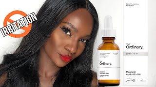 THE ORDINARY MANDELIC ACID  HA  HOW TO USE  REVIEW [upl. by Amadeo890]