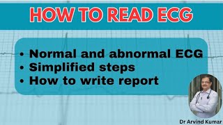 Mastering ECG Reading  Simplified Guide for Interns General Practitioners and Medicine Residents [upl. by Attezi]