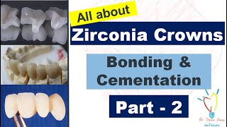 Zirconia Crowns  CEMENTATION vs BONDING [upl. by Lipkin941]