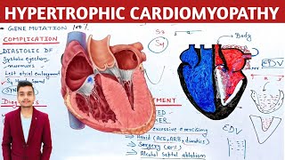 Hypertrophic cardiomyopathy pathophysiology in hindi [upl. by Enyallij]