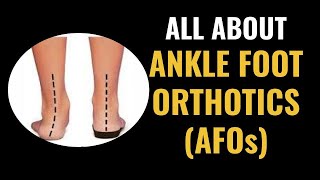 Types of AFOs Ankle Foot Orthotics for common foot conditions [upl. by Auqenehs]