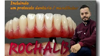 Incluindo um protocolo dentário  mandíbular [upl. by Llertnac184]