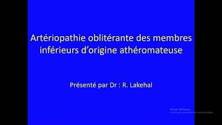 Artériopathie oblitérante des membres inferieurs [upl. by Querida391]