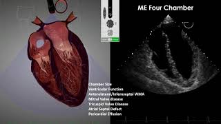 Transesophageal Echocardiography TEE Imaging [upl. by Namrac821]