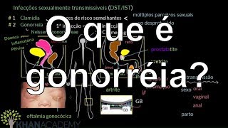 O que é gonorréia  Vida e evolução  Khan Academy [upl. by Ennyl]