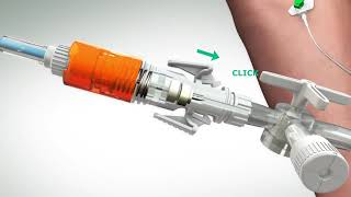 Chemfort®  Closed Administration using IV Safety Set Syringe Adaptor Lock and a Luer Lock Adaptor [upl. by Einaffit63]