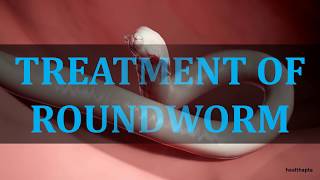 TREATMENT OF ROUNDWORM [upl. by Aihcropal]