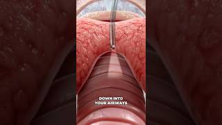 Bronchoscopy 3D Animation [upl. by Allebara]