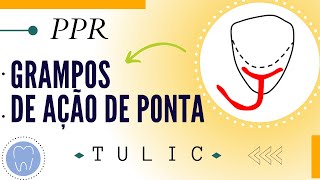 GRAMPOS DE AÇÃO DE PONTA  RETENTORES DIRETOS [upl. by Ravilob]