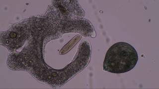 Amoeba hunts and kills paramecia and stentor to music by Lamar Genesis Winter Zimmer [upl. by Shepard]