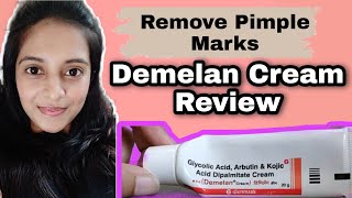 Demelan Cream  Precautions Review [upl. by Enilatan854]