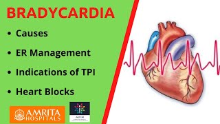 Causes amp Management of Bradycardia  Follow us on Twitter Link below👇 [upl. by Llenil]