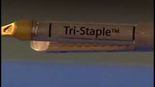 Endo GIA™ Reloads with Tri Staple™ Technology amp Endo GIA™ Ultra Universal Staplers LnsyxAlY9FM [upl. by Nonnah]