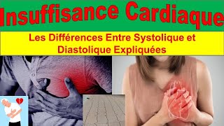 Insuffisance Cardiaque Congestive  Causes Symptômes et Traitements Avancés [upl. by Lorien]