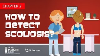 Ch2  How to detect scoliosis [upl. by Nnylrebma758]