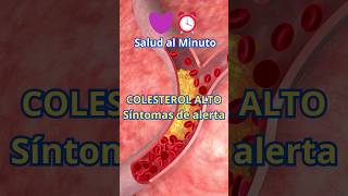 COLESTEROL ALTO  Sintomas de Alerta [upl. by Emmalee]