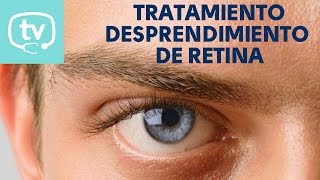 El tratamiento del desprendimiento de retina [upl. by Barbur]