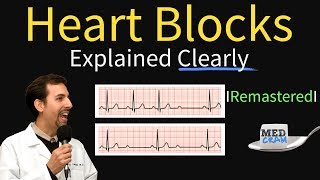 Heart Blocks Explained  First Second Third Degree and Bundle Branch on ECG [upl. by Magda]