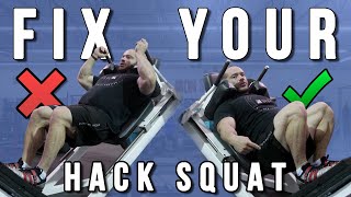 9 Hack Squat Mistakes and How to Fix Them [upl. by Neelrac]