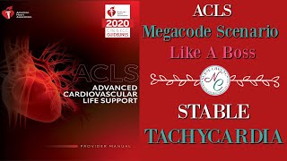 STABLE TACHYCARDIA IMPORTANT TIPS TO PASS THE 2020 ACLS MEGACODE SCENARIO LIKE A BOSS [upl. by Notsyrb]