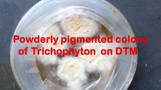 Trichophyton growth on dermatophyte test medium DTM Demo [upl. by Neelie]