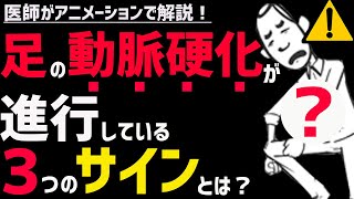 絶対に見逃してはいけない「足の動脈硬化」ASO（閉そく性動脈硬化症）の症状3選 [upl. by Iadrahs176]