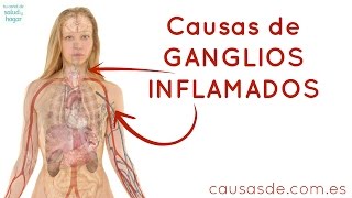 Causas de ganglios inflamados [upl. by Nivloc]