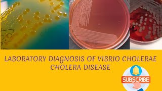 Laboratory diagnosis of Vibrio cholerae in hindi [upl. by Arno]