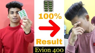 Evion 400  Vitamin E Capsules  Use For Hair Growth amp hair fall  Hair treatment  Oye Semii [upl. by Zolnay407]