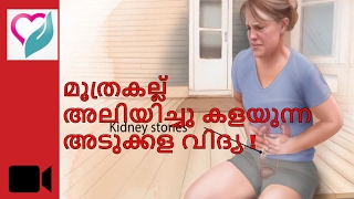 Kidney Stone Natural Treatment to dissolve stone  Malayalam  മൂത്രകല്ല്  Ethnic Health Court [upl. by Nosreg892]