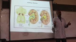 Gout and Hyperuricemia By Dr Dheyaa Jabbar [upl. by Asile]