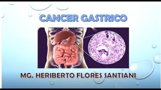 Cáncer gástrico  clase 11  fisiopatología [upl. by Ahsila]