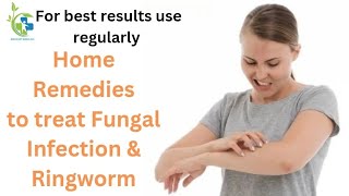 HOME REMEDIES TO TREAT FUNGAL INFECTION amp RINGWORM [upl. by Elatsyrc]